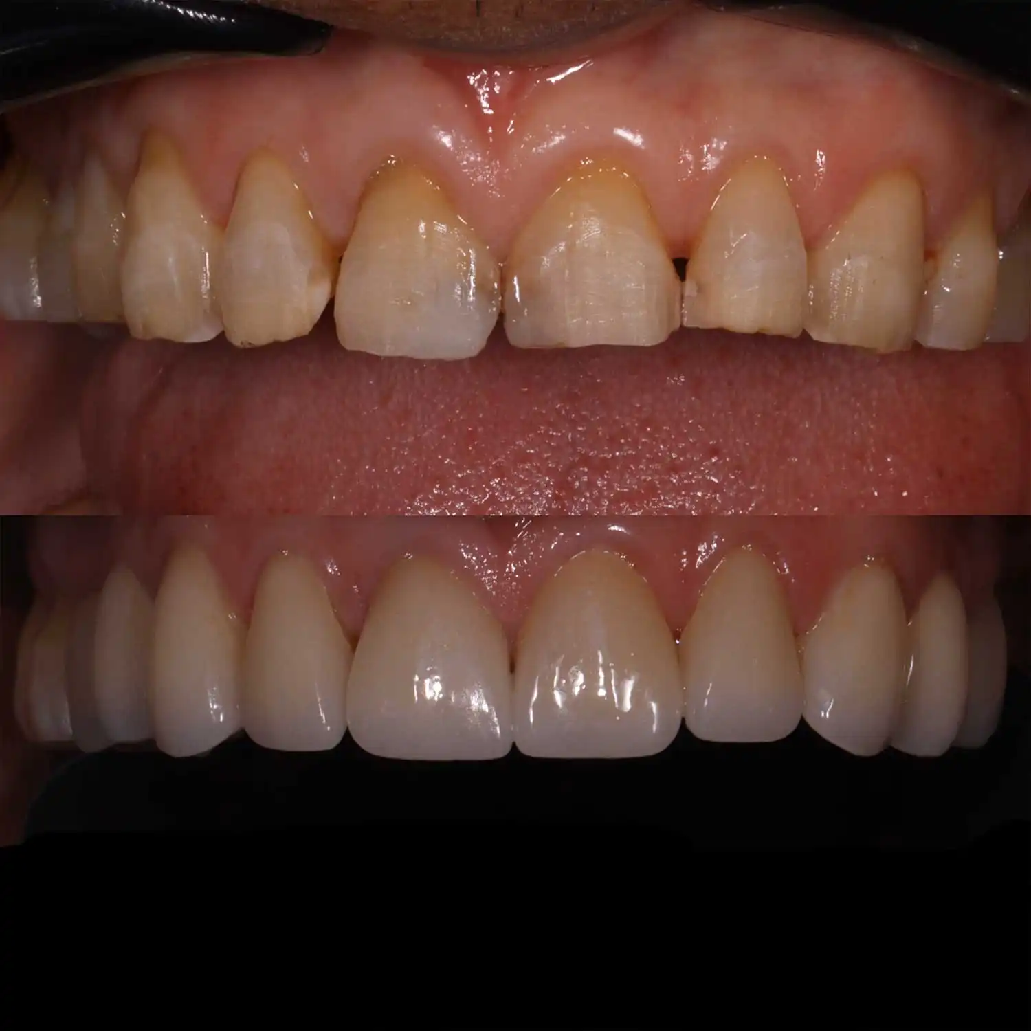 Rehabilitación Oral
